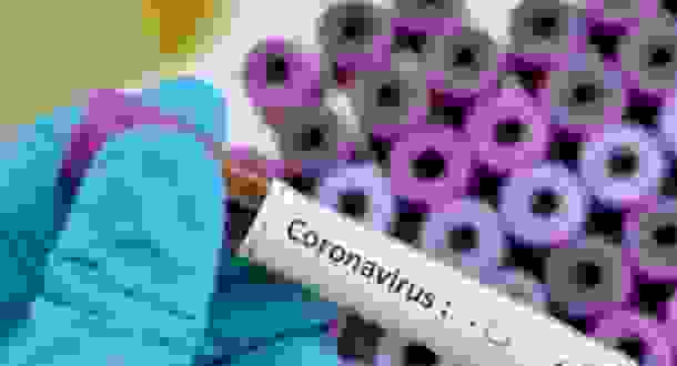 Tips Mengenali Risiko Terkena Infeksi Virus Corona